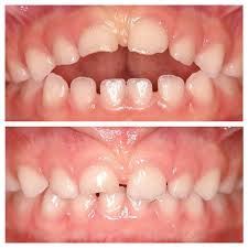 Airway-orthodontics.jpg